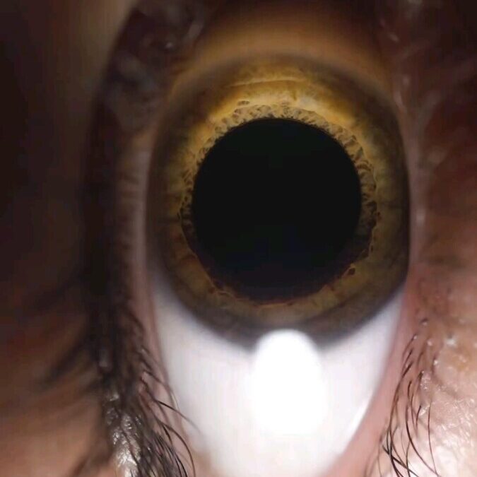 Symptômes de tension oculaire : comprendre et soulager vos yeux
