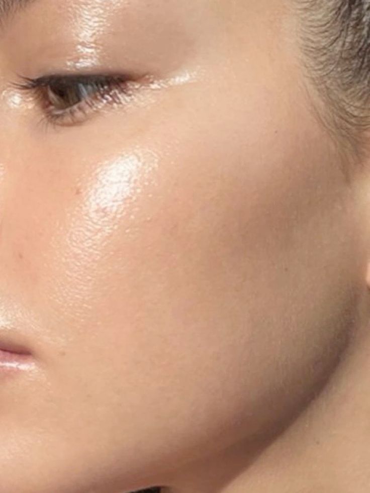 acide hyaluronique peau