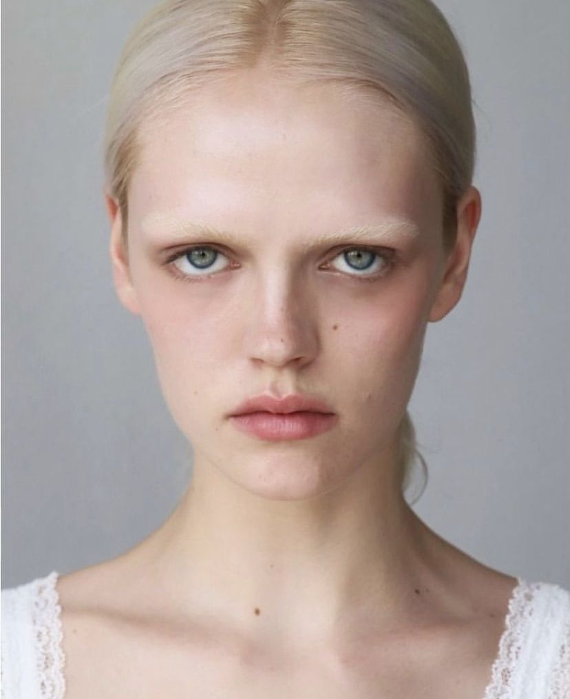 insuffisance vitamine d2 et d3 symptômes