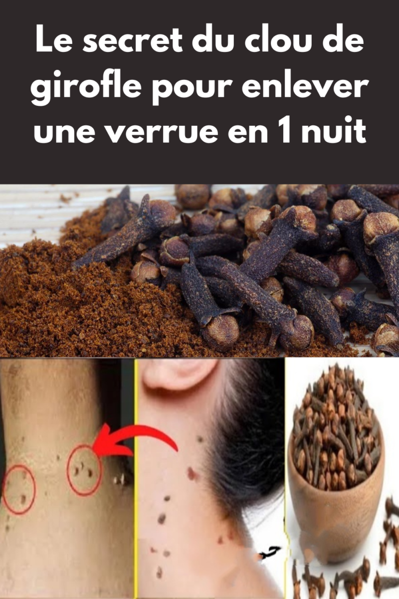 Furoncle Pubien Remèdes Maison