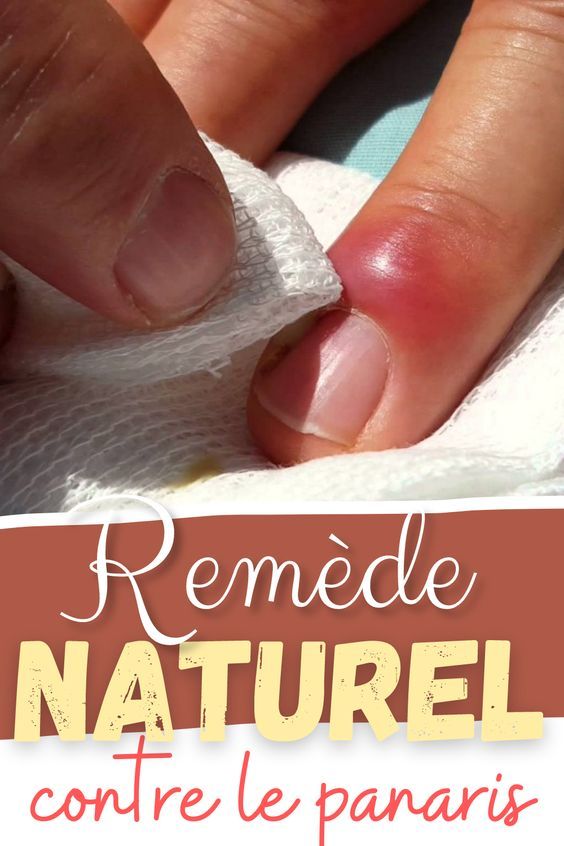 Éperon Calcanéen Foie Intestin