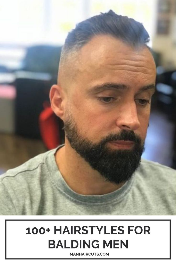 Coupe Cheveux Calvitie Tendance