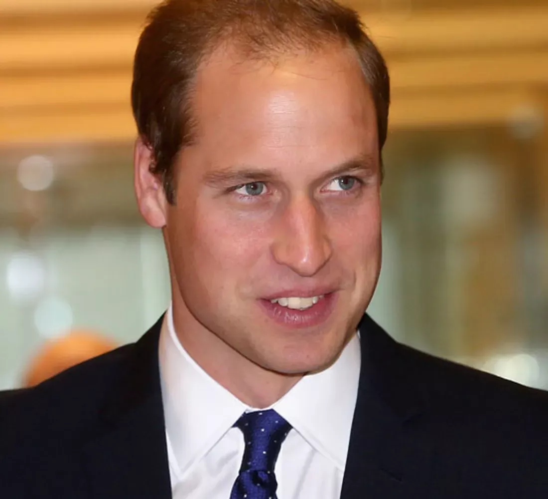 Coupe Cheveux Calvitie Tendance