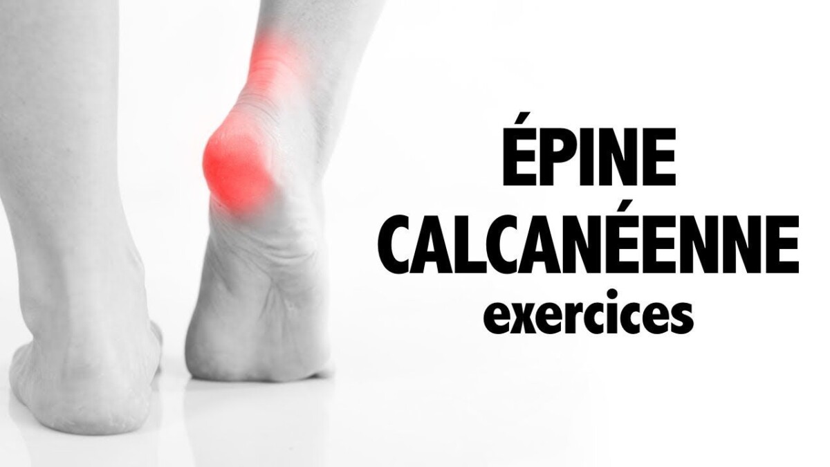 Éperon Calcanéen Solutions Naturelles