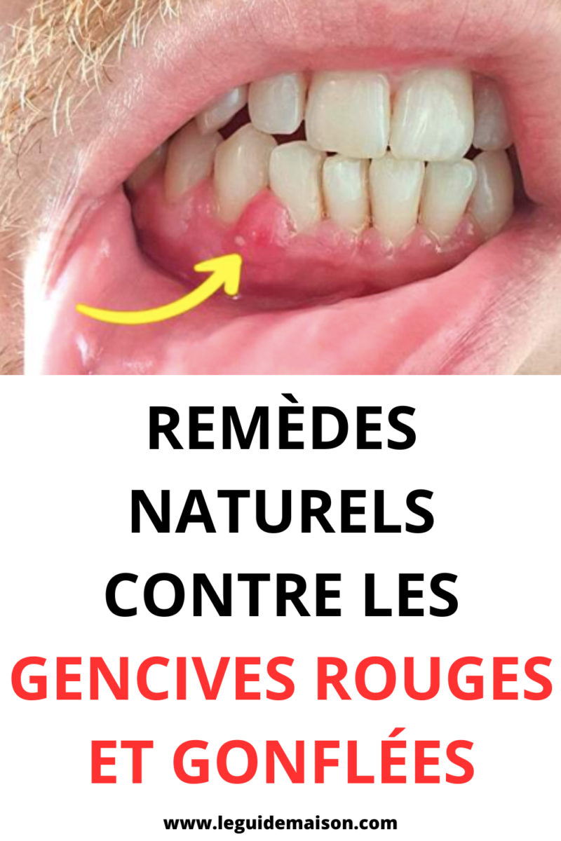 Furoncle Pubien Remèdes Maison