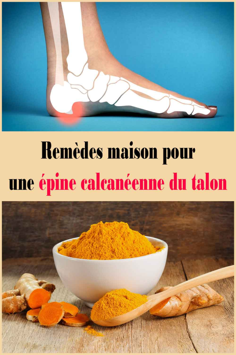 Éperon Calcanéen Solutions Naturelles