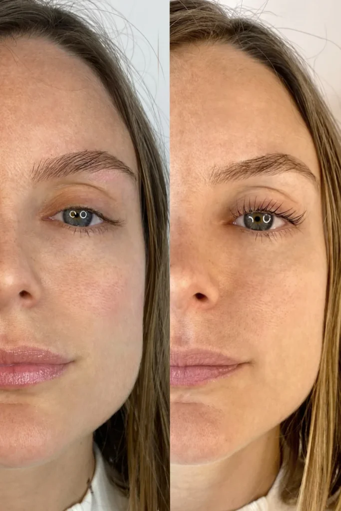 Rehaussement de cils