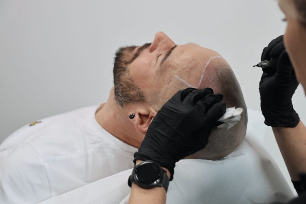 Tricopigmentation homme