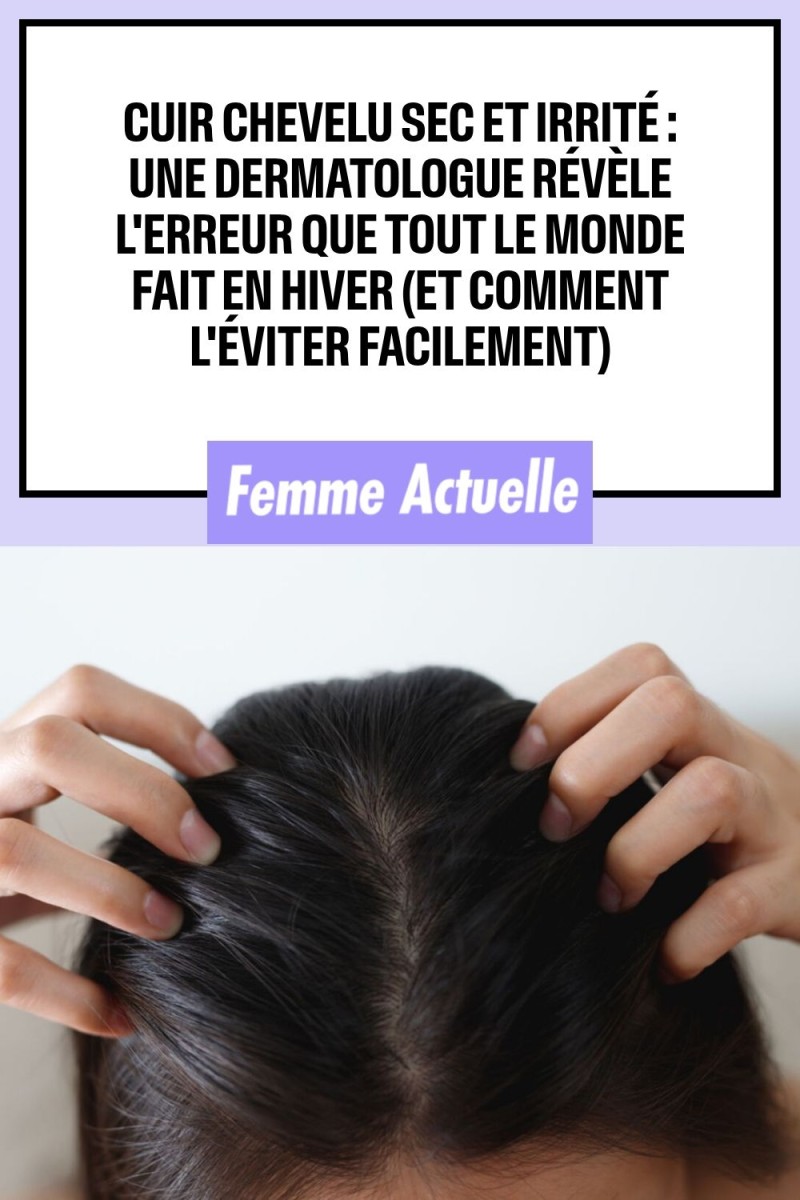 cuir chevelu